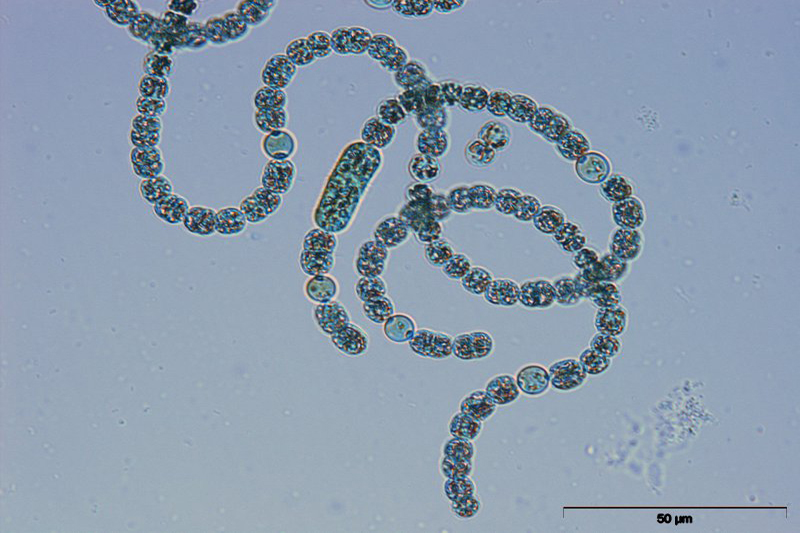 Mikroskopische Abbildung von Blaualgen (Cyanobakterien) 